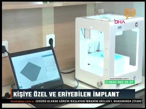 Kişiye özel eriyebilen implant projesi Line TV'de