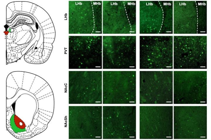 Oral ketamine prevents anhedonia