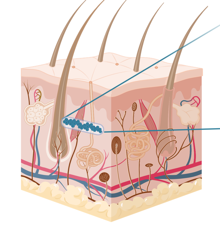 Nanopartikül ve Hidrojel Tabanlı Kablosuz Giyilebilir ve İmplant Sensörler