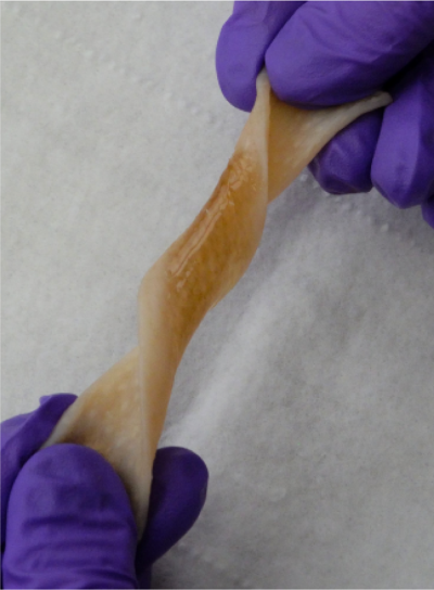 Rubbery Wound Closure Adhesives. I. Design, Synthesis, Characterization, and Testing of Polyisobutylene-Based Cyanoacrylate Homo- and Co-Networks