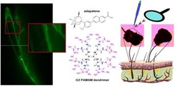 Dermal Delivery and Follicular Targeting of Adapalene using PAMAM Dendrimers