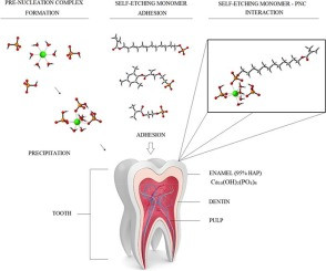 Binding of Self-Etching Monomers to Hydroxyapatite: A Computational Approach
