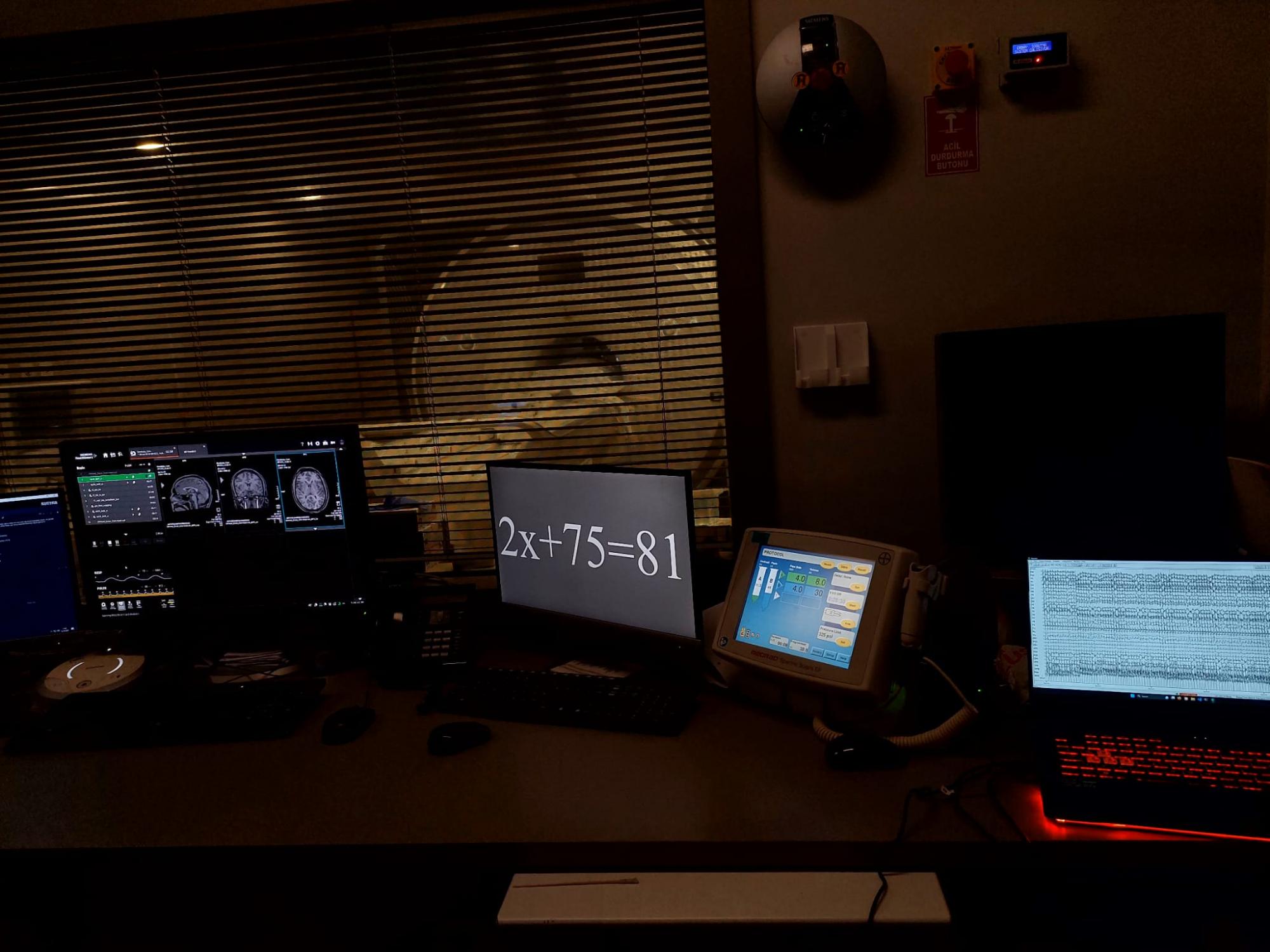 EEG-fMRI Experiment