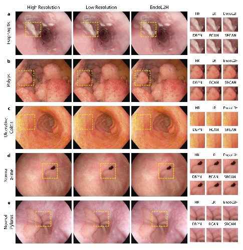 https://github.com/CapsuleEndoscope/EndoL2H/raw/master/imgs/SR_performance.png