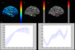 https://neurosignal.bogazici.edu.tr/sites/neurosignal.bogazici.edu.tr/files/deniz11-300x201.png