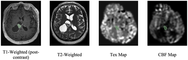 A picture containing medical imaging, screenshot, x-ray film, x-ray</p><p>Description automatically generated